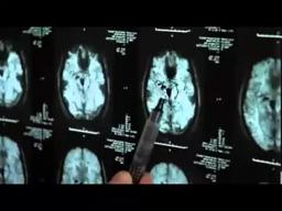 The Crash Reel trailer