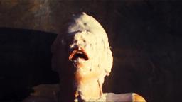 Maxine Suffocates In Her Cast