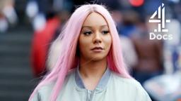 Transgender Model Undergoes Facial Surgery to Match Her Femininity